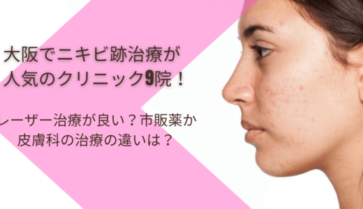 大阪でニキビ跡治療が人気のクリニック9院！レーザー治療が良い？市販薬か皮膚科の治療の違いは？